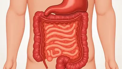 drazdivy tracnik co to je a jak se s ním vypořádat – Dráždivý tračník – příznaky, diagnostika a účinné způsoby léčby